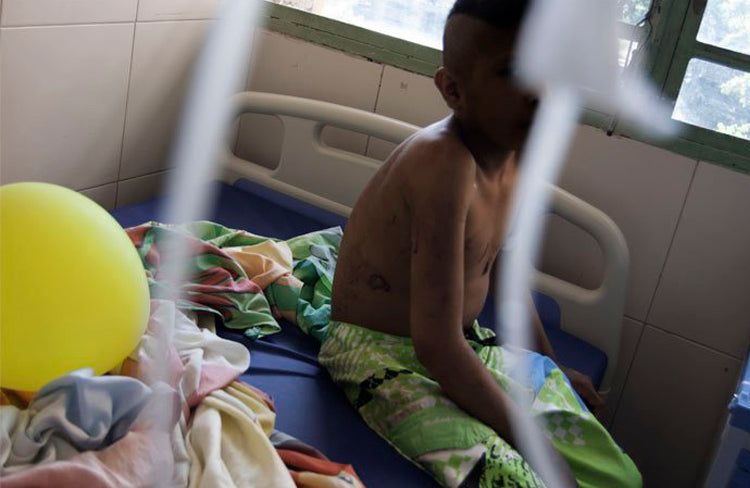DE 54% a 68% AUMENTÓ LA DESNUTRICIÓN INFANTIL EN VENEZUELA